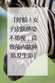 好险！女子皮肤感染不重视，竟致颅内脓肿危及生命